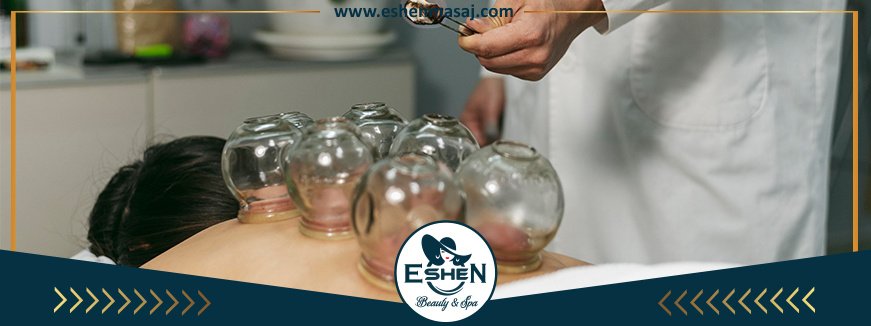 Cupping Masajı Çorlu Cupping Masajı Çorlu