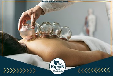 Cupping Masajı Çorlu